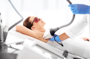 Woman on laser hair removal